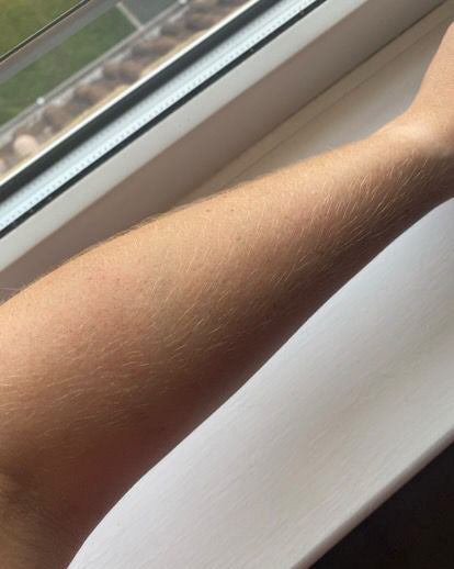 A close-up of a person's forearm resting on a white windowsill next to a window frame, with a hand near the top right corner.
