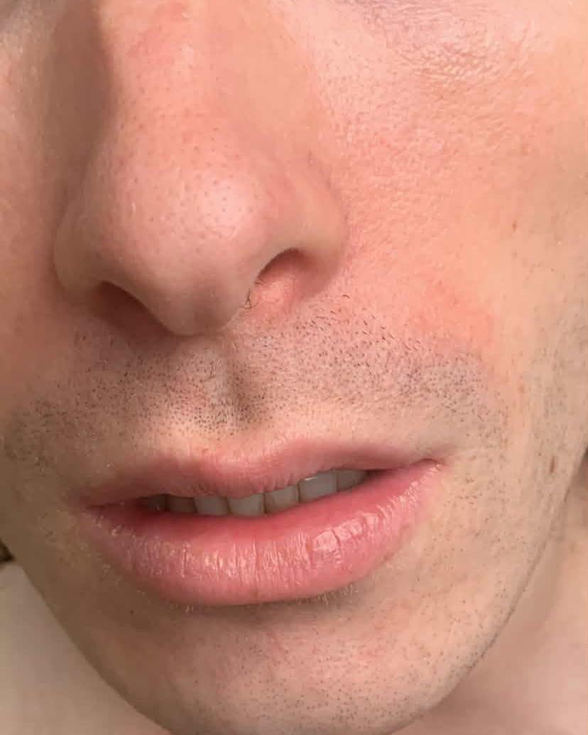 Extreme close-up of a person's lower face, showing the nose, lips, chin, and light stubble on fair skin.